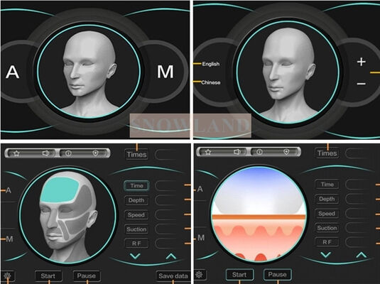 Ημιαγωγός 808nm Laser Diode Laser Machine Αποτρίχωσης με αισθητήρα επαφής με το δέρμα που εξασφαλίζει ταχεία θεραπεία αποτρίχωσης